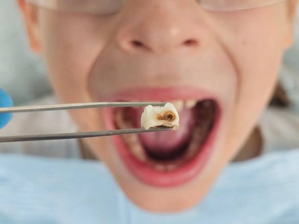 Best Broken Tooth Emergency  in Lake Havasu City, AZ